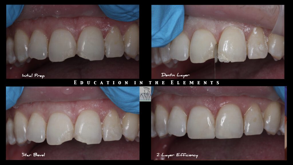 Collage of teeth and gums