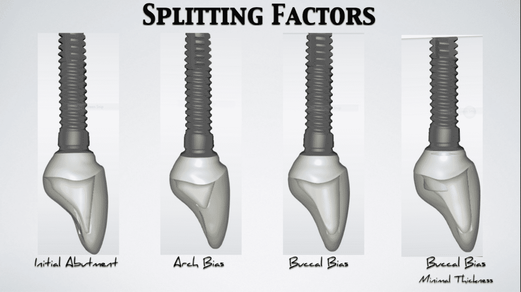A diagram of several types of digital implant teeth