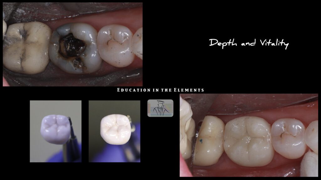 Collage of teeth with Ceramic Artistry before and after shots
